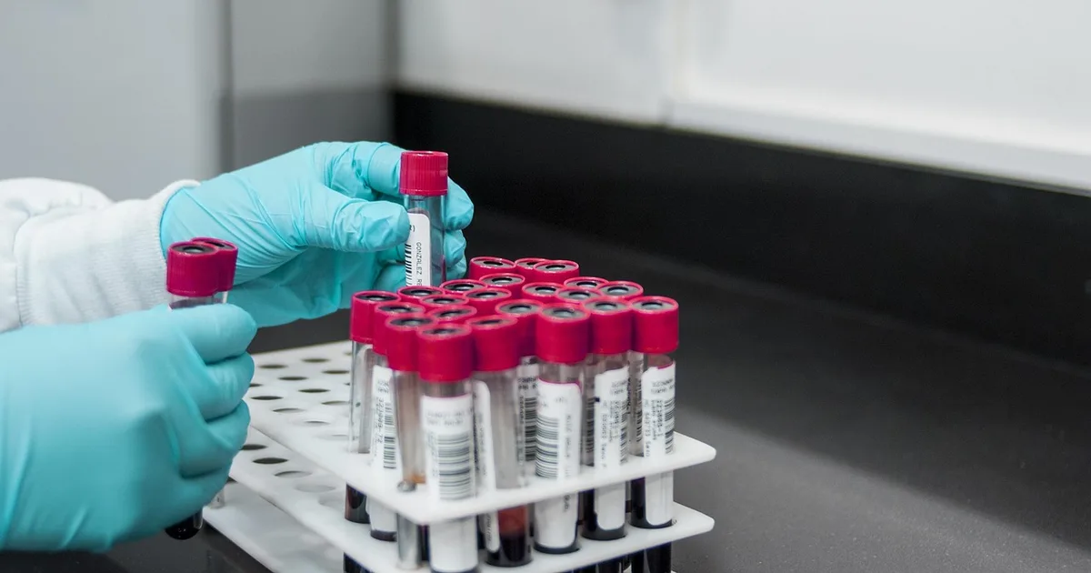 Blood samples being processed in a laboratory