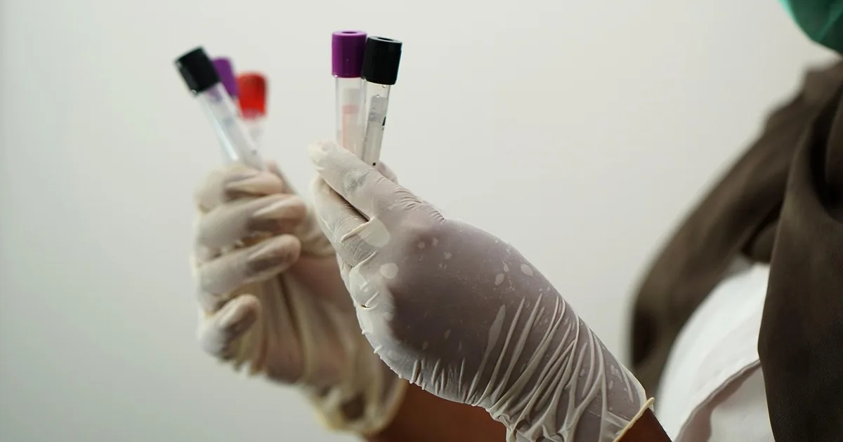 Test tubes in a laboratory